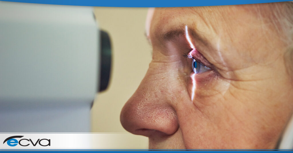 Understanding Glaucoma | Eye Care & Vision Associates