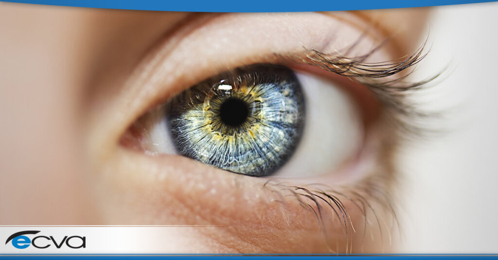 what-causes-eye-color-to-change