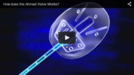 How the Ahmed Valve Works - provided by ECVA Eye Care