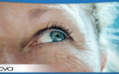 How and Why Do Cataracts Form?