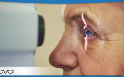 Combined Cataract and Glaucoma Surgery: What to Expect