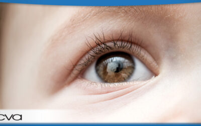 Congenial (Pediatric) Cataracts – What It Is and How It’s Treated